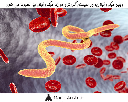 وجود میکروفیلاریا در سیستم گردش خون میکروفیلارمیا نامیده می شود